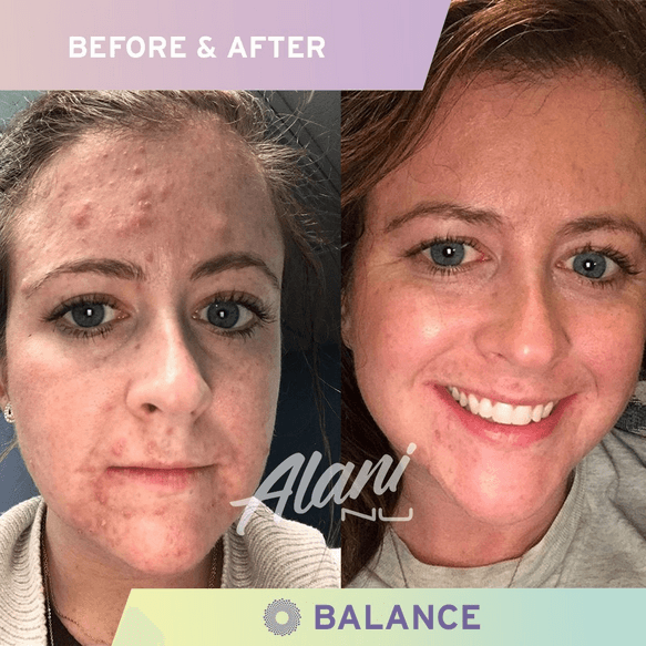 alani nu testominal of balance